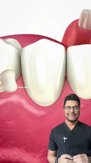 #greenscreenvideo They make a Ton | gum recession