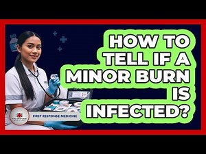 How To Tell If A Minor Burn Is Infected?