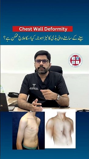 Chest Wall Deformity Explained | Meet a Thoracic Surgeon in Lahore