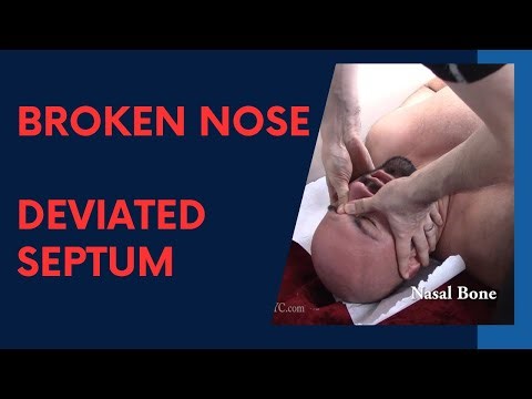 Boxer with Broken Nose, Deviated Septum HELPED by Dr Suh
