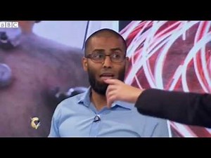 What is cupping and does it work BBC News