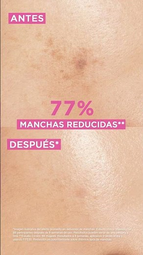 Sérum Glycolic Bright reduce las manchas en tu piel