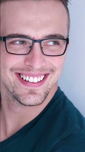 What Is Eye Tooth? (5 Definitive Functions and Importance)