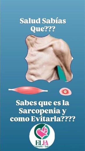 Salud Sabías Que??? Sabes que Es la Sarcopenia y como Evitarla??