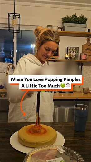 Popping my giant pimple cake 🎂🤢 | Twisted