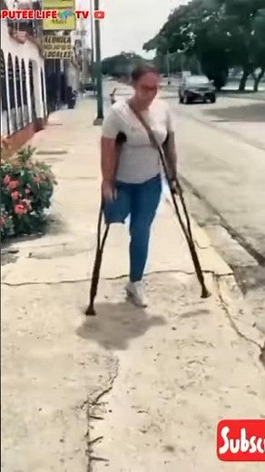 Amputee lady crutches user: adaptive walking #limbloss #crutches