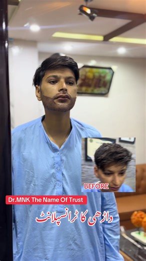 Hair Transplant Services at Hair Xpert Clinic Peshawar