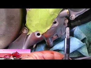 Aluminum Thread Repair Using a Time-Sert Repair Kit