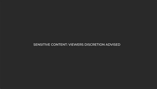 In light of recent incidents involving aggressive interactions between stray dogs and passengers and staff, we acknowledge the concern this may cause. Please be assured that passenger safety remains our highest priority. 1/4