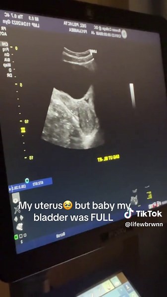 Ultrasound Positioning of the Uterus Explained