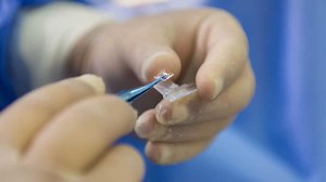 A first-of-its-kind procedure lets 83-year-old Italian man regain sight