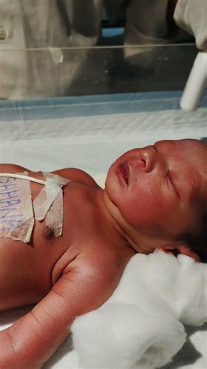 new born baby being chestrpy 😘💉♥️👍 #youtubeshorts #trending #viralbaby #cute #chestrip#hospital#work