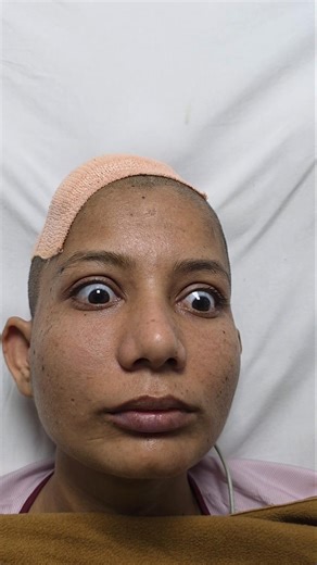 “Patient can’t look up… but the problem is NOT in the eyes.” Parinauds Syndrome #neurosurgery