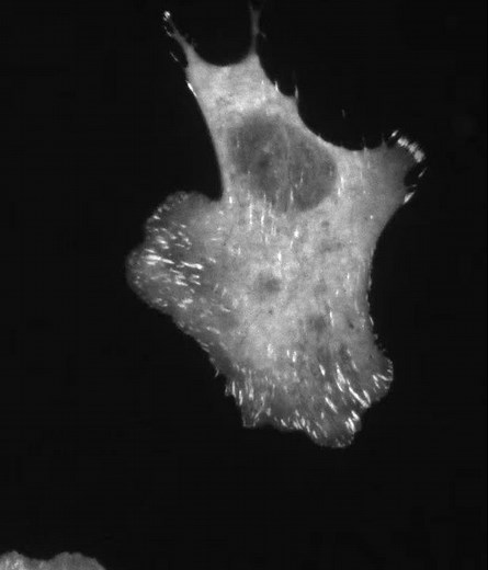 Focal adhesion dynamics in a migrating human cell