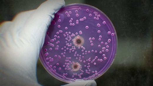 Revise: Cell division and its role in growth and repair - National 4 Biology - Video - BBC Bitesize