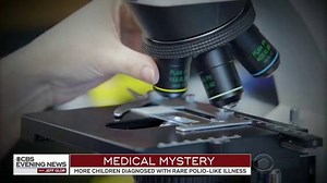 5K views · 32 reactions | ACUTE FLACCID MYELITIS SYMPTOMS: -Sudden onset of arm or leg weakness -Difficulty moving facial muscles -Slurred speech and trouble swallowing The CDC says there have been 38 confirmed cases of AFM. the rare, poorly understood illness with polio-like symptoms, this year through the end of September. https://cbsn.ws/2IL7xih | CBS Evening News | Facebook