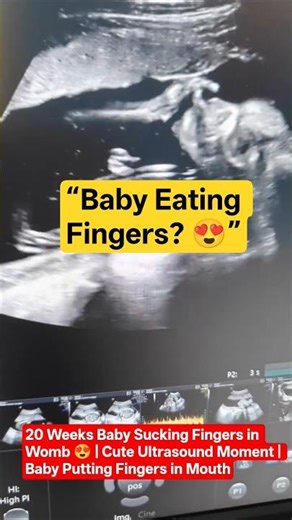 Anomaly scan/Level lI scan