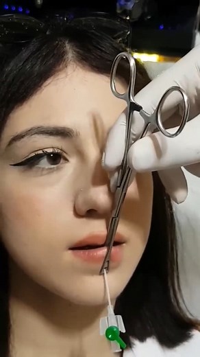 Lip piercing #piercing #art #tutorial #montreal #reelsfypシ #MarkZuckerberg #facebookreels #mexico #usa #germany #england #virals #foryoupagereels #fypシ | Albertson