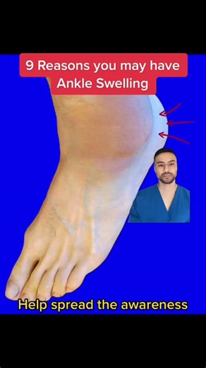 The Good Foot Doctor - Ram on TikTok