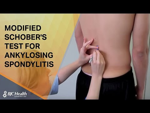 Modified Schober's Test for Ankylosing Spondylitis