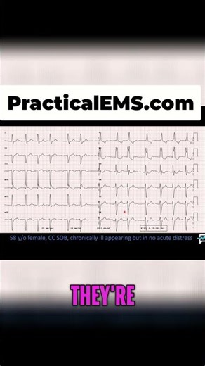 Decoding Heart Rhythms: When to Intervene? (Medical Secrets!) #shorts