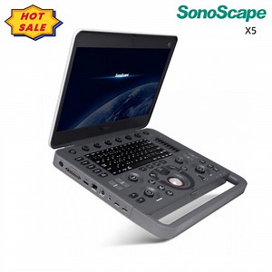 [Hot Item] High Performance 3D Cardiac Ultrasound Scanner Sonoscape X5 Notebook Ultrasound Machine with Probe