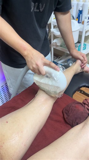 Triệt lông toàn thân từ đầu tới chân | Triệt lông vĩnh viễn hướng dẫn