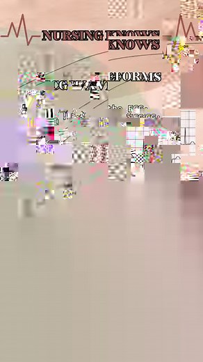 37K views · 1.1K reactions | Nursing quiz 喙  ECG WAVEFORMS | ...