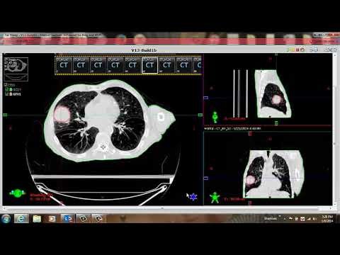 Recording of Contouring Tools for 4D Planning for Eclipse User