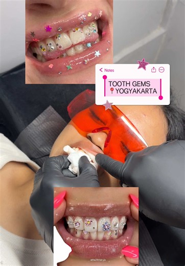 Tooth Gems Jogja: Cara Coba & Review Naykilla yang Super Lucu