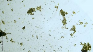 Unicellular organisms and algae under microscope magnification freshwater sample