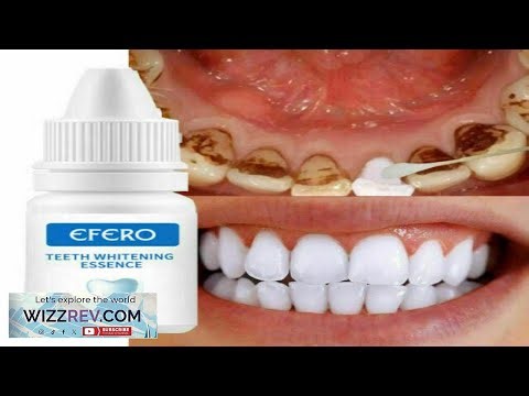 Teeth Whitening Powder Toothpaste Powder Cleaning Effective Remover Tooth Stains eBay