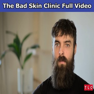 Gigantic Lipoma Dr. Emma Removes Mass on Patient's Chest | Save My Skin | Sethani 1