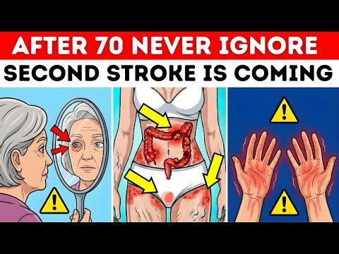 OVER 70? 9 Second Stroke Warning Symptoms (Miss #5 at Your Risk)