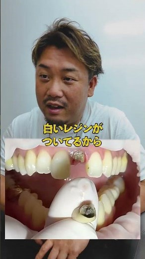 A dentist explains the treatment for a broken dental crown! [Metal Core]