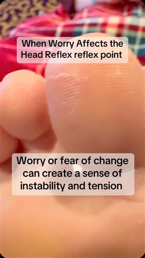 When Worry Affects the Head Reflex reflex point-Worry or fear of change can create a sense of instability and tension that can be felt throughout the body, but is often most noticeable in the head. In reflexology, the head reflex point can often be affected and may feel quite sensitive to touch for your client. Visually, it can sometimes present with peeling or flaky skin. #Reflexology #HeadReflex #AnxietyRelief #RelaxationTips #GentleTouch | Irish School of Reflexology & Wellness