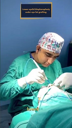 Under Eye bag removal | Lower Lid Surgery | Blepharoplasty before after #blepharoplasty #fatgrafting