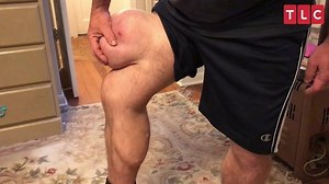 Dr. Pimple Popper Before the Pop Episode 3 Exclusive Video