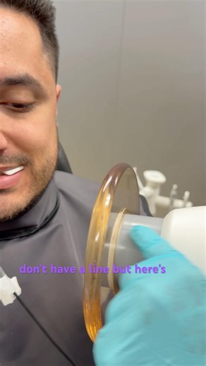 How to take bitewings with a NOMAD #dentalhygiene #dentist #dentalassistant #dentalhygienestudent