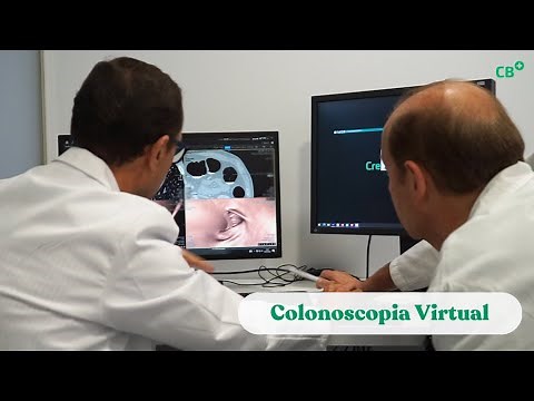Colonoscopia Virtual: prevención y diagnóstico precoz del cáncer de colon