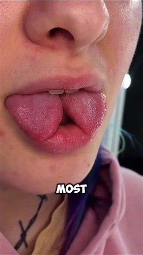 Why Did The Doctor Split Their Tongue? 👅