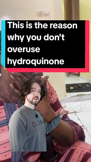 Side effects of hydroquinone over use. #skincaregonewrong #skincareadviceforyou #hydroquinonemisuse #skincareviral #Meme #MemeCut #CapCut