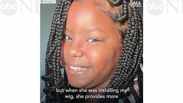 Woman who makes children's wigs helps girl with alopecia