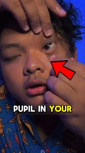Two Pupils in One Eye! | Hidden Cell