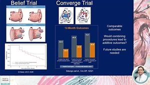 Role of LAA Exclusion in the Management of Atrial Fibrillation