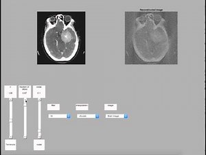 Filtered back projection (X-ray CT) with noise.