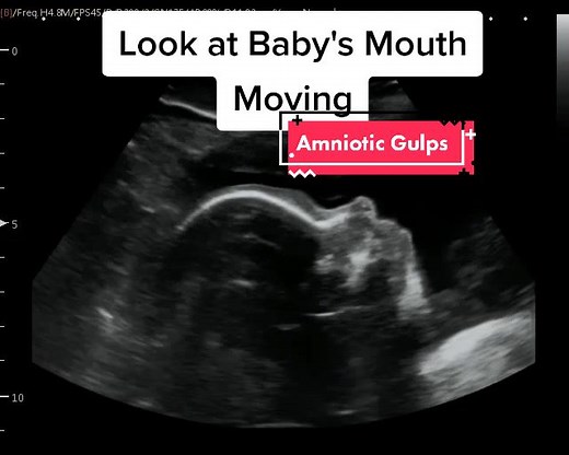 Baby Chewing: Insights on Ultrasound Scans