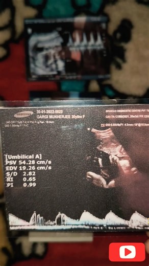 Positive First Response Pregnancy Test-Real Time ✅🥰❤️#viralvideo #pregnancy #pregnant #testkit #cute