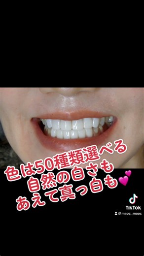 #女医 #セラミック矯正 #ワイヤー矯正 #マウスピース矯正 #インプラント矯正 総合診断 歯肉整形 ガミースマイル ボトックス 予約困難 歯茎ラミネートベニア削らないベニア
