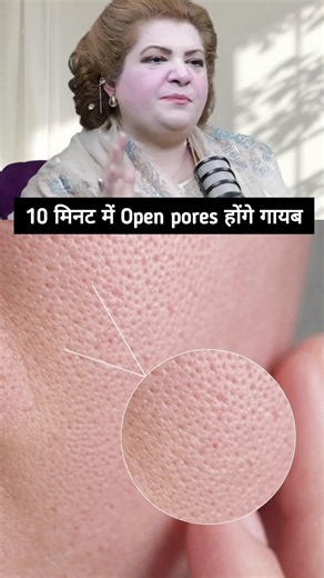 Best face pack for open pores😍#openpores #clearskin #scars #dullskin #remedies #viralreel#shortviral